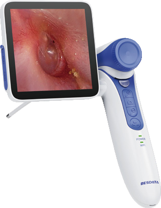ENT endoscope with flexible and rigidE-pocket - VOT-1000